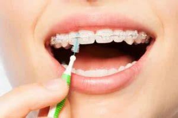 Can interdental brushes damage gums?