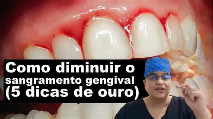 Como mexer na gengiva durante a gravidez?