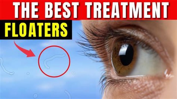 How can I get rid of eye floaters?