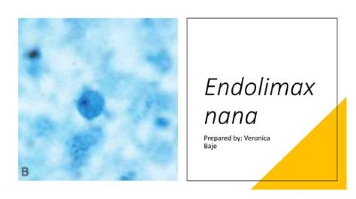 How is Endolimax Nana cyst treated?