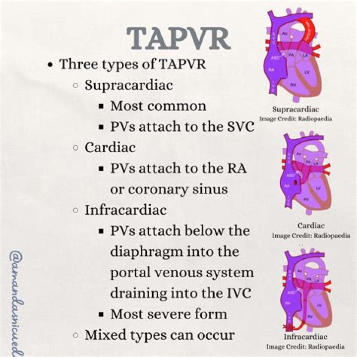 How rare is TAPVR?