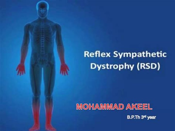 Is Reflex Sympathetic Dystrophy a disability?