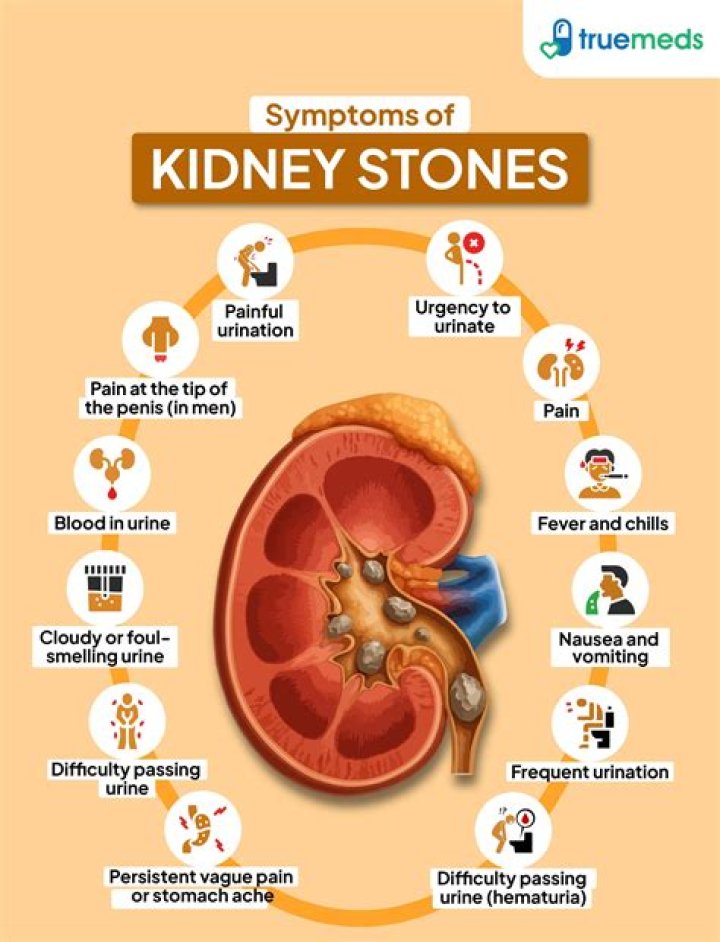 What are the disadvantages of kidney stone?