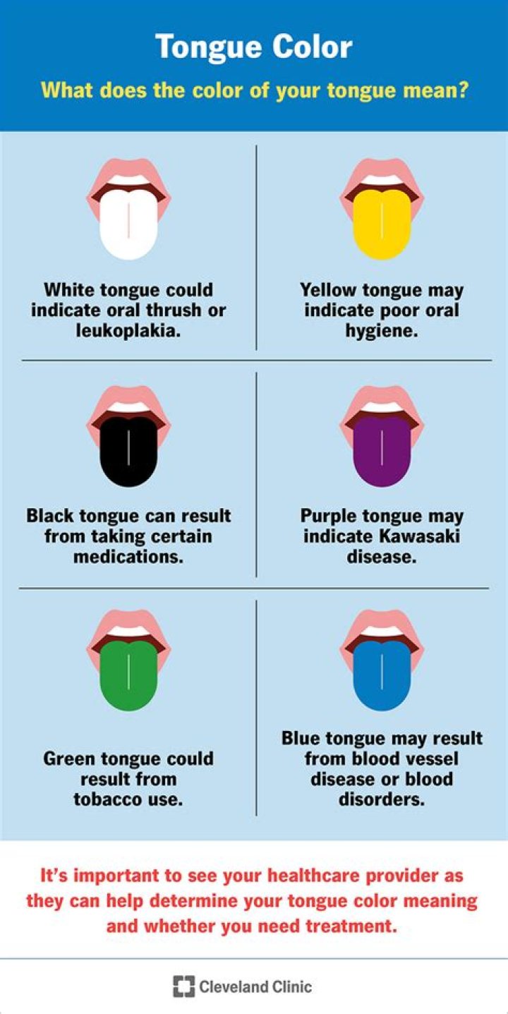What color is your tongue when you have Covid?
