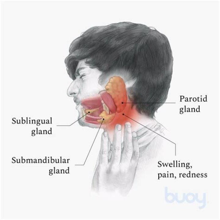 What does a swollen gland under your chin mean?