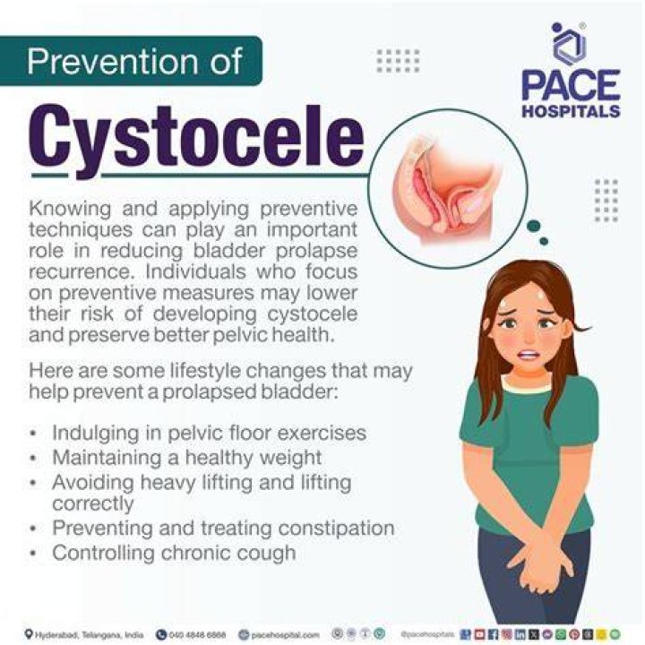 What does the term cystocele mean?