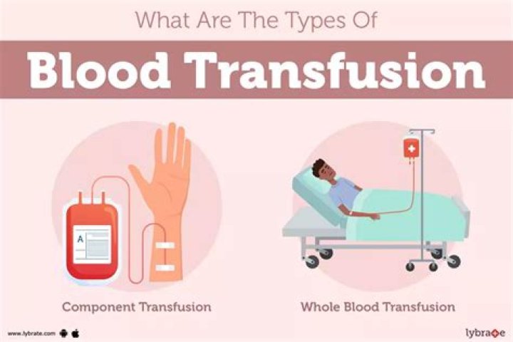 What is intrauterine blood transfusion?