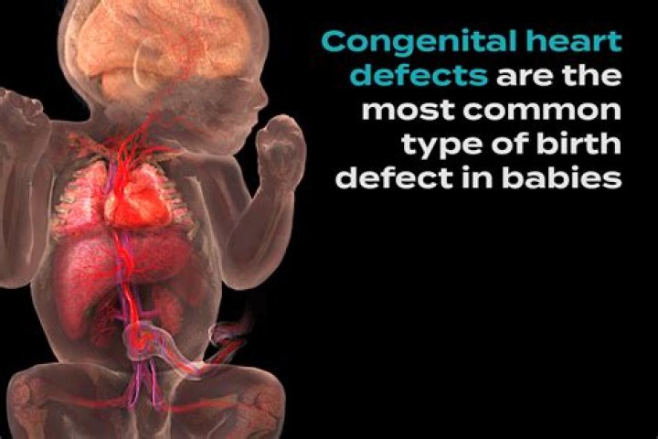 What is pediatric congenital heart defects?