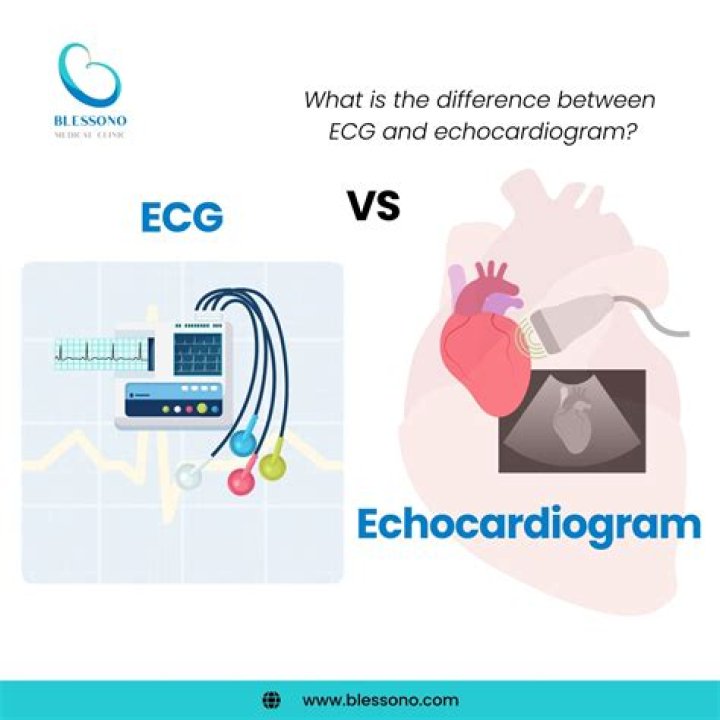 What is the difference between an ECG and EKG machine?