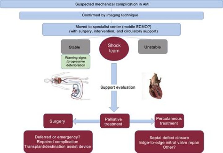 What is the most common complication of myocardial infarction?