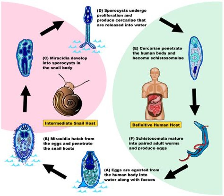 What is the pathology of schistosomiasis?
