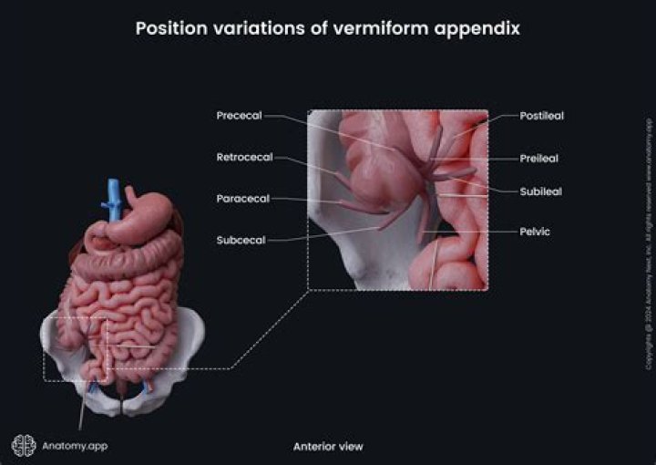 What is Vermiform movement of Iris?