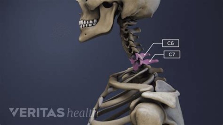What nerves do C6/C7 affect?