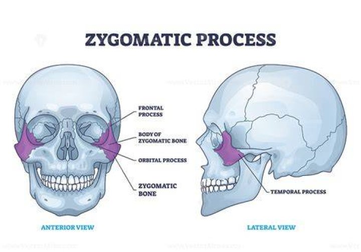 What processes form the zygomatic arch?