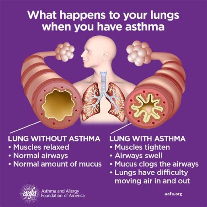 What should you assess for asthma?