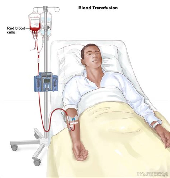 When is hemodilution used?