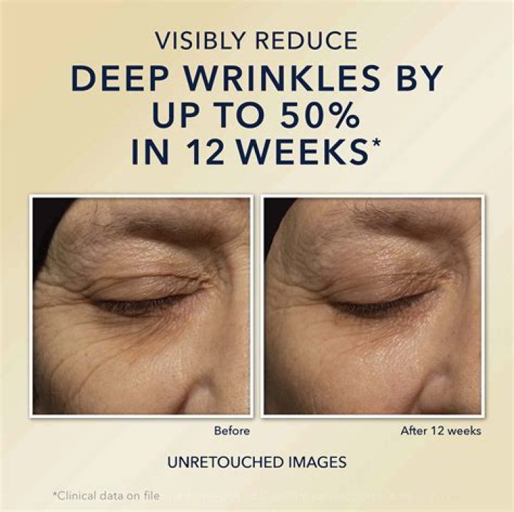 Which No7 product is best for deep wrinkles?
